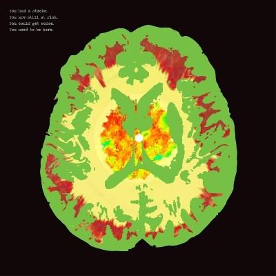 Minus 5, The - Stroke Manor