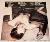 Brain Tumors - Brain Tumors