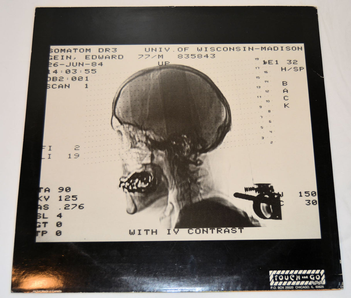 Killdozer - Little Baby Buntin'