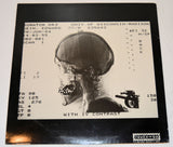 Killdozer - Little Baby Buntin'